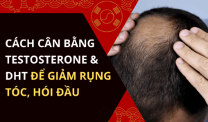 Cách cân bằng testosterone và DHT để giảm rụng tóc, hói đầu