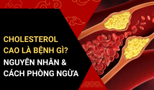 Cholesterol cao là bệnh gì