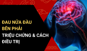 Đau Nửa Đầu Bên Phải