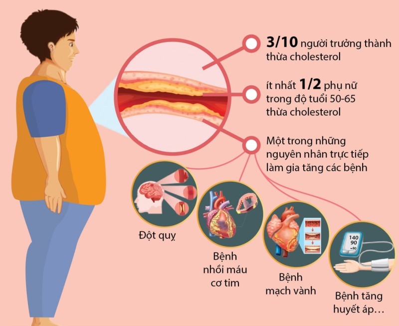 Nguyên nhân gây tăng cholesterol và tầm quan trọng của việc giảm cholesterol