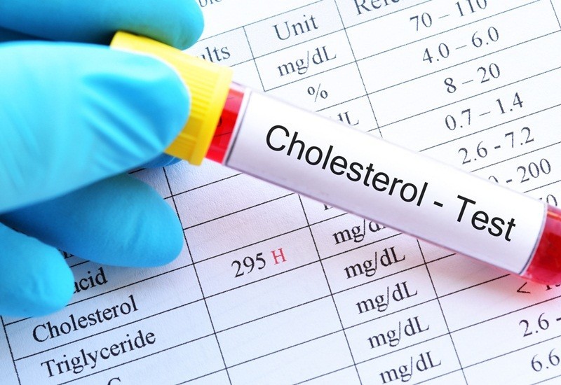 Làm sao để kiểm soát và giảm cholesterol xấu hiệu quả?