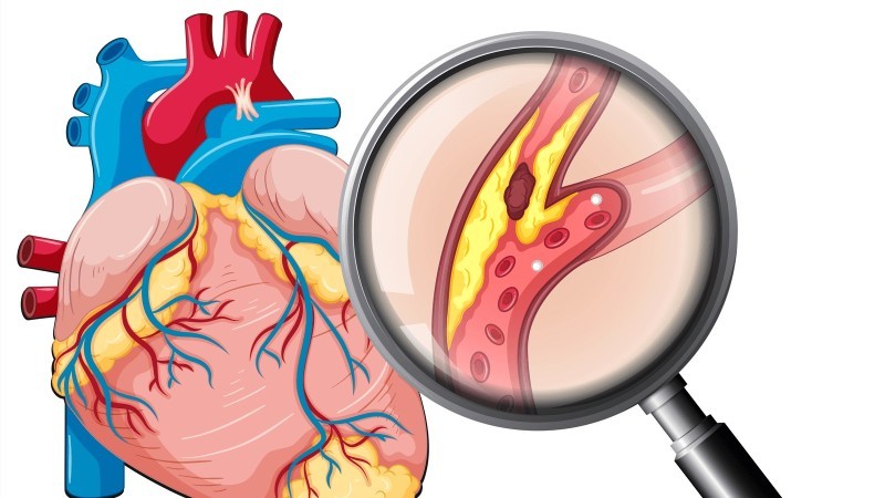 Hỗ Trợ Điều Trị Và Phòng Ngừa Một Số Bệnh Lý Mãn Tính