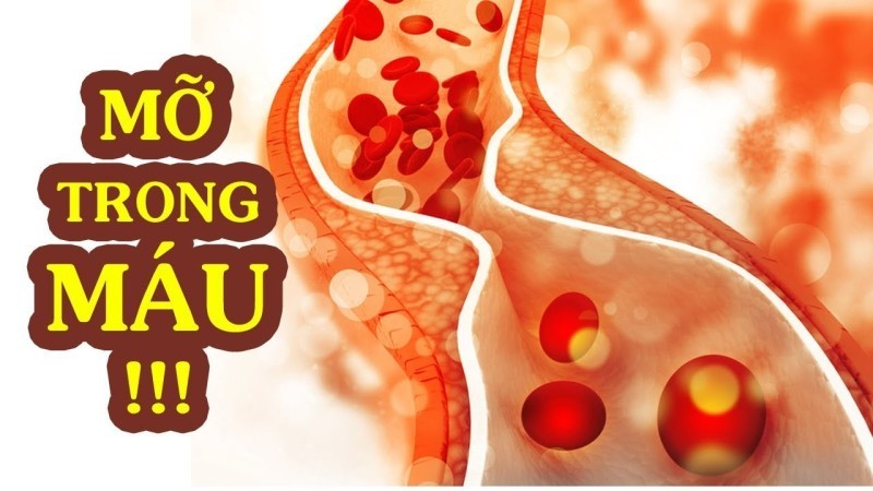 Máu nhiễm mỡ là gì?