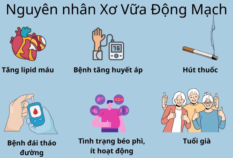Bệnh Xơ Vữa Động Mạch Là Gì?