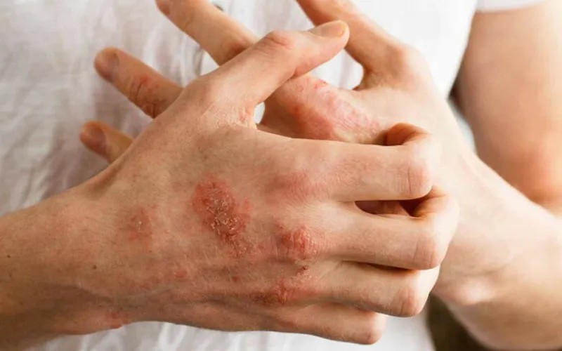 Có lúc hệ miễn dịch của cơ thể phản ứng sai – và điều đó có thể gây hại