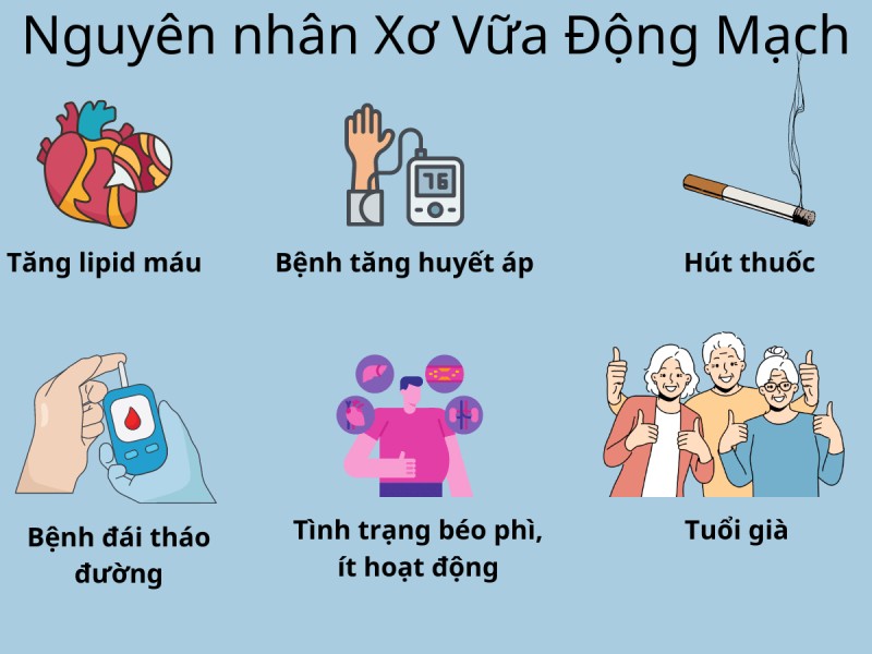 Những nguyên nhân xơ vữa động mạch bạn cần biết